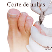 Corte profissional é o que você precisa para parar de errar e encravar suas unhas